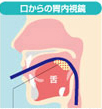口からの胃内視鏡