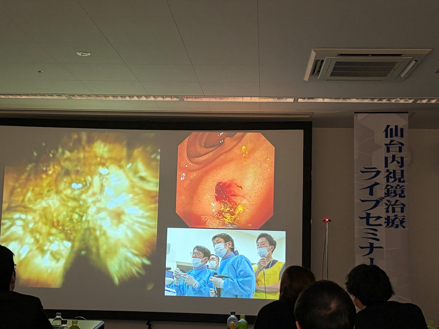 仙台内視鏡治療ライブセミナーに参加しました