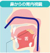 鼻からの胃内視鏡
